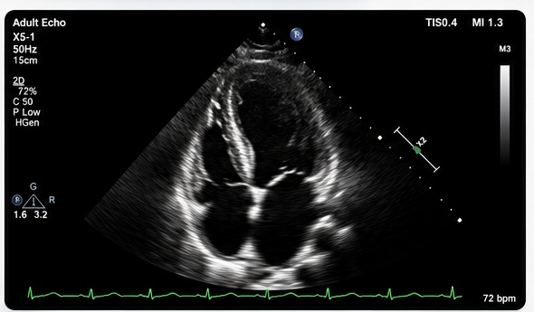 वास्तविक इकोकार्डियोग्राम (echocardiogram) को प्रतिनिधि चित्र